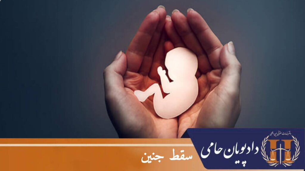 سقط جنین